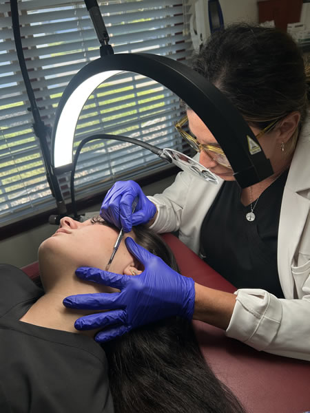 dermaplaning
